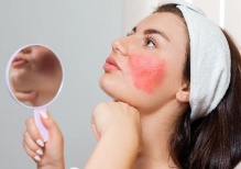 Аллергия и кожа лица: причины, подходящая косметика и способы устранения следов