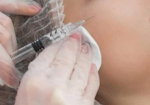 Удаление следов акне с помощью инъекционных филлеров: эффективный и безопасный способ восстановления кожи