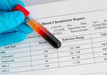 Высокий холестерин в крови: как с ним бороться? 